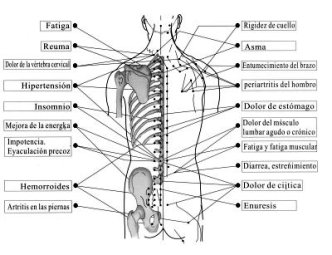 acupuntura